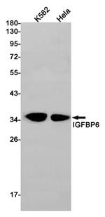 IGFBP6 Recombinant Rabbit Monoclonal Antibody (K01_1S74)