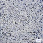 FAM98B Antibody in Immunohistochemistry (Paraffin) (IHC (P))