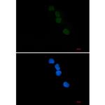SAE1 Recombinant Rabbit Monoclonal Antibody (K01_1Y06)