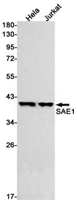 SAE1 Antibody in Western Blot (WB)