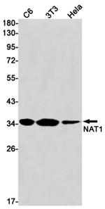 NAT1 Recombinant Rabbit Monoclonal Antibody (K01_1U40)