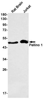 Pellino 1 Recombinant Rabbit Monoclonal Antibody (K01_1W56)