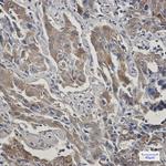 STIP1 Recombinant Rabbit Monoclonal Antibody (K01_1Y80)