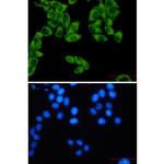 Fumarase Recombinant Rabbit Monoclonal Antibody (K01_1R17)