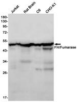 Fumarase Antibody in Western Blot (WB)