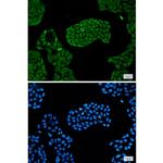PSMC5 Recombinant Rabbit Monoclonal Antibody (K01_1X29)