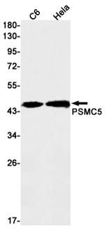 PSMC5 Antibody in Western Blot (WB)