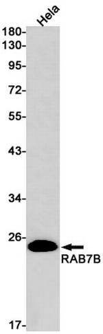 RAB7B Antibody in Western Blot (WB)