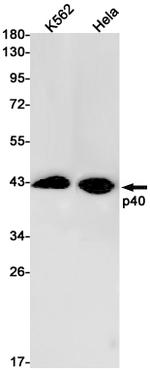 p40 Recombinant Rabbit Monoclonal Antibody (K01_1W20)