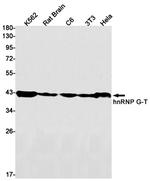 RBMXL2 Recombinant Rabbit Monoclonal Antibody (K01_1S37)