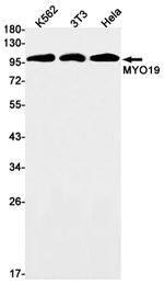 MYO19 Recombinant Rabbit Monoclonal Antibody (K01_1U36)
