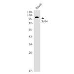SALL4 Recombinant Rabbit Monoclonal Antibody (K01_1Y08)
