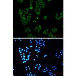 UPF1 Antibody in Immunocytochemistry (ICC/IF)