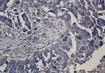 UPF1 Antibody in Immunohistochemistry (Paraffin) (IHC (P))