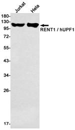 UPF1 Antibody in Western Blot (WB)