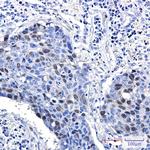 Cyclin A2 Antibody in Immunohistochemistry (Paraffin) (IHC (P))