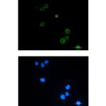 CD100 Recombinant Rabbit Monoclonal Antibody (K01_1Y23)