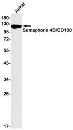 CD100 Antibody in Western Blot (WB)
