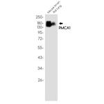 PMCA1 ATPase Antibody in Western Blot (WB)