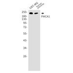 PMCA1 ATPase Recombinant Rabbit Monoclonal Antibody (K01_1W90)