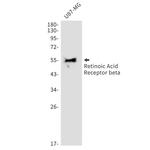 RARB Recombinant Rabbit Monoclonal Antibody (K01_1X75)