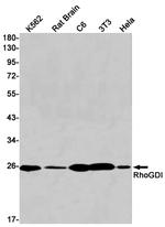 RhoGDI Recombinant Rabbit Monoclonal Antibody (K01_1X77)