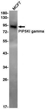 PIP5K1C Antibody in Western Blot (WB)
