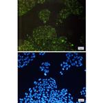 cIAP1 Recombinant Rabbit Monoclonal Antibody (K01_1P56)