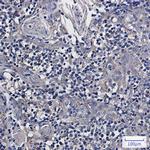 NDUFS6 Antibody in Immunohistochemistry (Paraffin) (IHC (P))