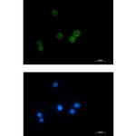 LCK Recombinant Rabbit Monoclonal Antibody (K01_1T42)