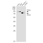 TFE3 Recombinant Rabbit Monoclonal Antibody (K01_2J23)