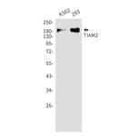 TIAM2 Recombinant Rabbit Monoclonal Antibody (K01_2J29)