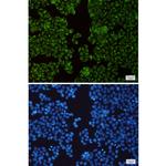 TIMM44 Recombinant Rabbit Monoclonal Antibody (K01_2J31)