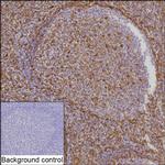 STING Recombinant Rabbit Monoclonal Antibody (K01_2J33)