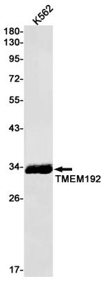 TMEM192 Recombinant Rabbit Monoclonal Antibody (K01_2J34)