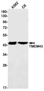TMEM43 Antibody in Western Blot (WB)