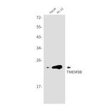 TMEM9B Recombinant Rabbit Monoclonal Antibody (K01_2J39)
