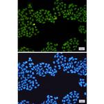 TOP1 Recombinant Rabbit Monoclonal Antibody (K01_2J42)
