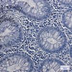 TOP1 Antibody in Immunohistochemistry (Paraffin) (IHC (P))