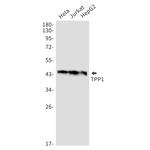 CLN2 Recombinant Rabbit Monoclonal Antibody (K01_2J44)