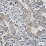 TAX1BP1 Recombinant Rabbit Monoclonal Antibody (K01_2J47)