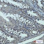 TGM2 Antibody in Immunohistochemistry (Paraffin) (IHC (P))