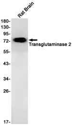 TGM2 Antibody in Western Blot (WB)