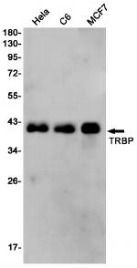 TRBP Recombinant Rabbit Monoclonal Antibody (K01_2J52)