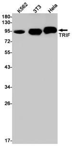 TRIF Recombinant Rabbit Monoclonal Antibody (K01_2J54)