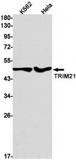 TRIM21 Recombinant Rabbit Monoclonal Antibody (K01_2J55)