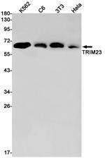 TRIM23 Antibody in Western Blot (WB)