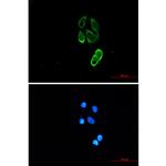 TRIM25 Recombinant Rabbit Monoclonal Antibody (K01_2J58)
