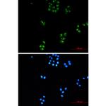 TRK fused gene Recombinant Rabbit Monoclonal Antibody (K01_2J59)
