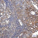 TRK fused gene Antibody in Immunohistochemistry (Paraffin) (IHC (P))